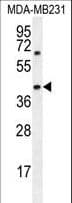 Polyclonal Rabbit anti-Human AMACR / P504S Antibody (aa323-351, IHC, IF, WB)