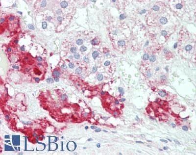 IHC-plus™ PDGF-D Antibody (aa191-370)