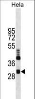 Monoclonal Mouse anti-Human CLIC4 Antibody (clone 17CT9.2.8, IHC, WB)