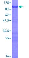 Human AKAP5 / AKAP79 Protein (Recombinant GST)
