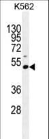 PRAMEF10 Antibody (aa396-424)