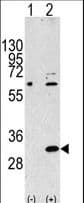 Polyclonal Rabbit anti-Human EIF4E2 / IF4e Antibody (aa12-41, IHC, WB)