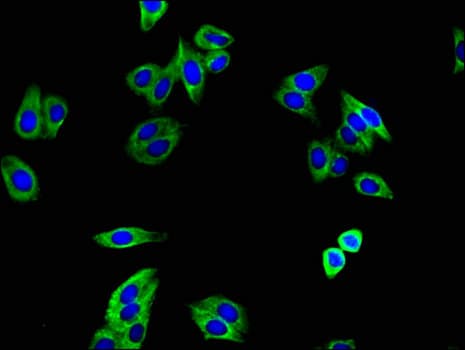 Polyclonal Rabbit anti-Human TGFBR1 / ALK5 Antibody (IHC, IF, WB)