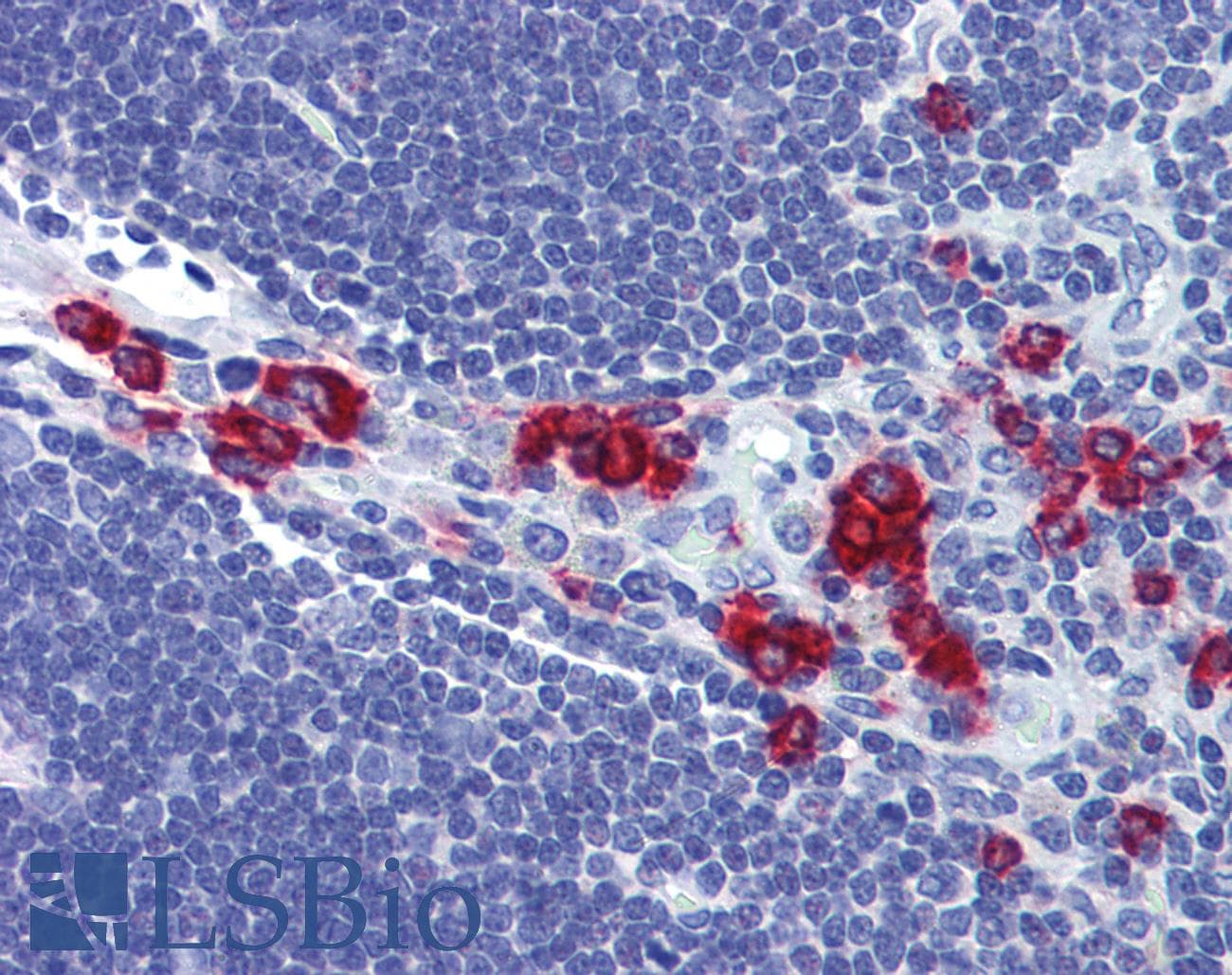 IHC-plus™ RASSF2 Antibody (aa11-22)