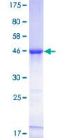 Human PDE4DIP / MMGL Protein (Recombinant GST)