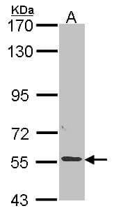 Polyclonal Rabbit anti-Human ALPPL2 Antibody (aa46-344, IHC, WB)