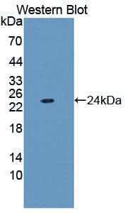 FTL / Ferritin Light Chain Antibody (Biotin)