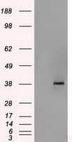 SORD / Sorbitol Dehydrogenase Antibody (clone OTI2A10)