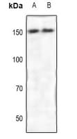 ROCK2 Antibody