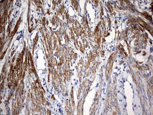 KLHL12 Antibody (aa177-405, clone OTI4E1)