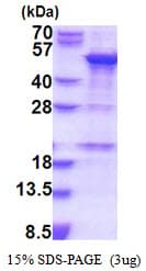 Human SNAPC1 Protein (Recombinant His)