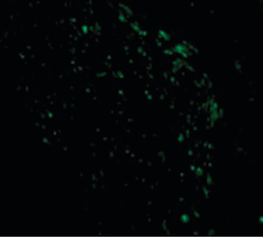 IHC-plus™ PMAIP1 / NOXA Antibody