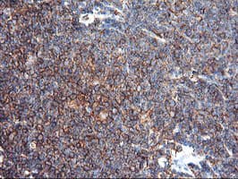 ENPEP / Aminopeptidase A Antibody (clone OTI3G1)