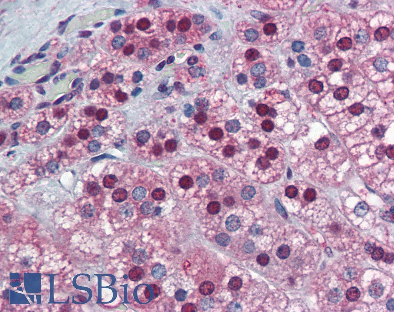 IHC-plus™ SUGP2 / SFRS14 Antibody