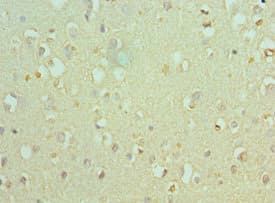 Polyclonal Rabbit anti-Human BAF53B / ACTL6B Antibody (aa1-280, IHC)