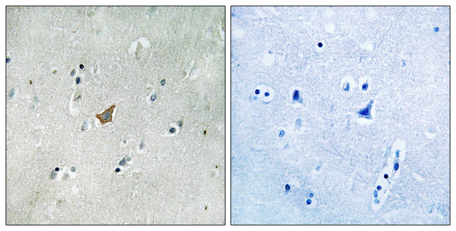 Polyclonal Rabbit anti-Human EPHA3 + EPHA4 + EPHA5 Antibody (phospho-Tyr779/Tyr833, IHC)