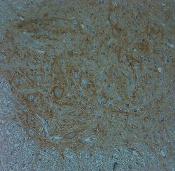 Polyclonal Rabbit anti-Human ACAN / Aggrecan Antibody (aa200-250, IHC)