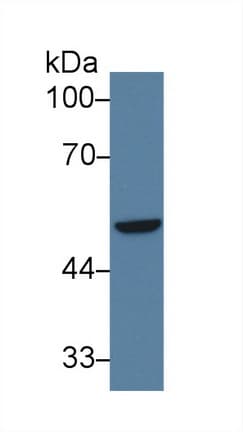 IRF6 Antibody (aa196-445, APC)