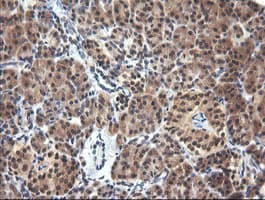 PARVA Antibody (clone OTI1C11)