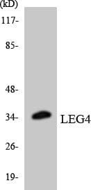 LGALSL / Galectin 5 Antibody (aa34-83)