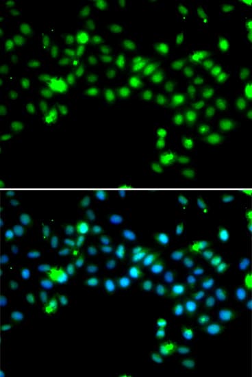 SRSF4 / SFRS4 Antibody