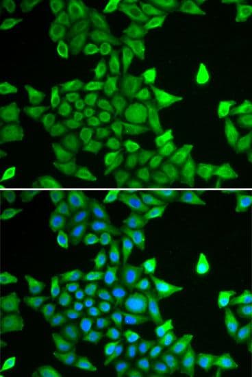Polyclonal Rabbit anti-Human PSMA6 Antibody (IHC, IF, WB)