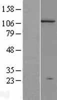 DNMT3A Protein (Over-Expression Lysate Myc-DDK (Flag))