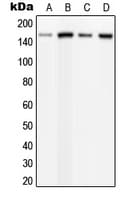 PLCB3 Antibody (phospho-Ser537)
