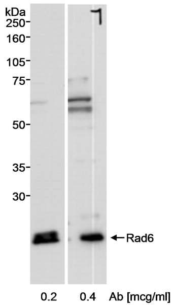 Polyclonal Rabbit anti-Human UBE2A Antibody (N-Terminus, IHC, WB)