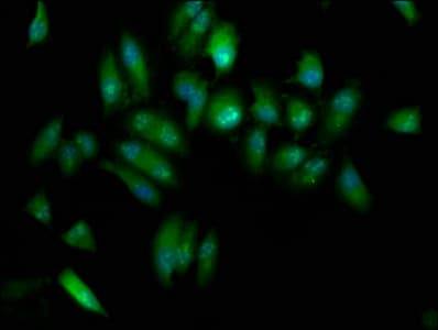Polyclonal Rabbit anti-Human ELP3 Antibody (IF, WB)