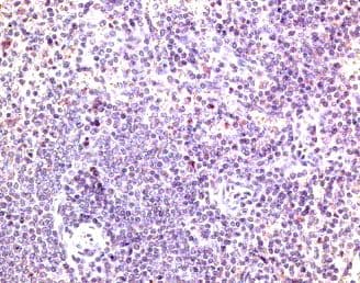 Polyclonal Goat anti-Mouse CCR7 Antibody (aa2-22, IHC, WB)