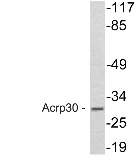 Polyclonal Rabbit anti-Human Adiponectin Antibody (aa6-55, WB)