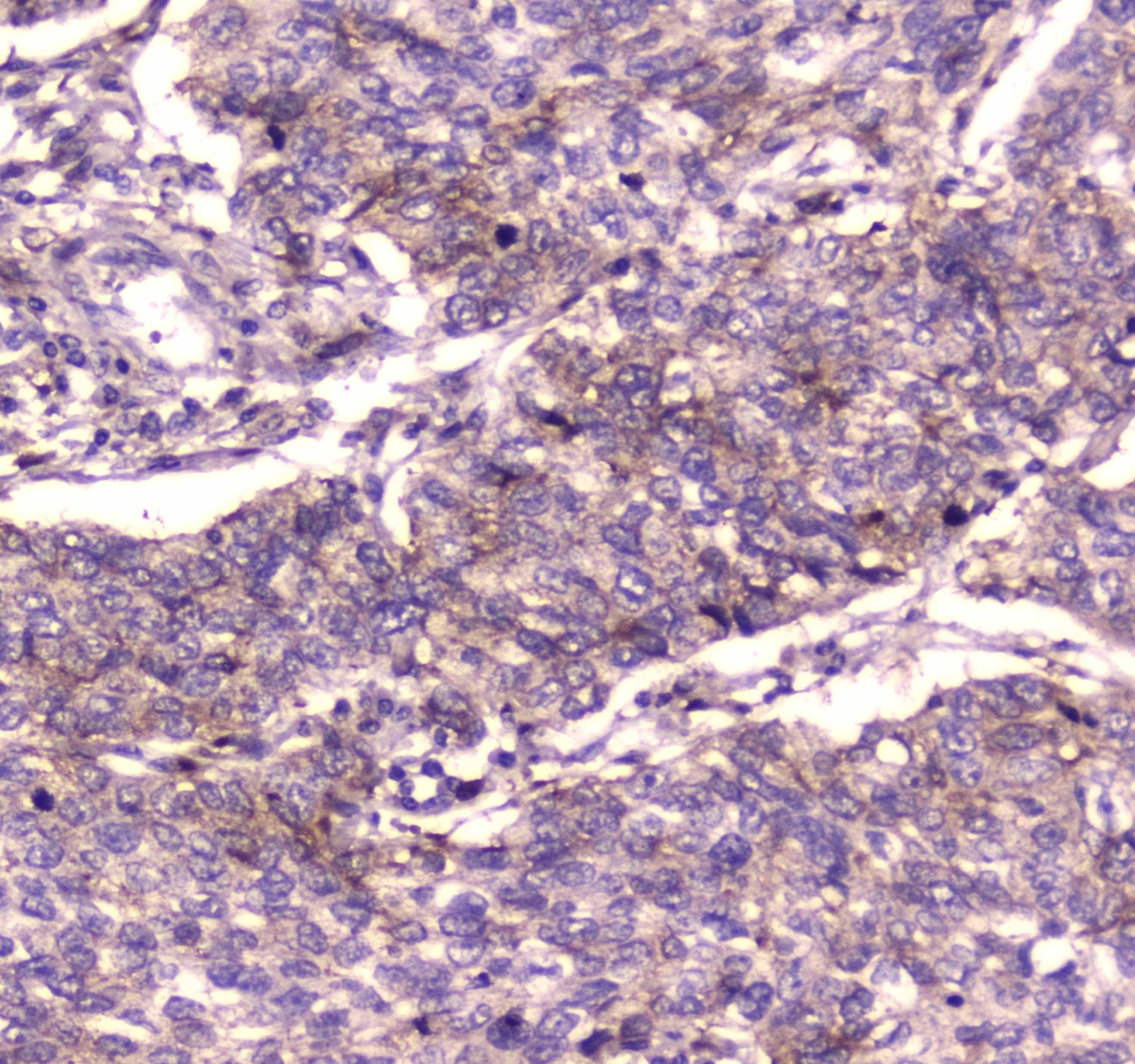 IGF2R / CD222 Antibody