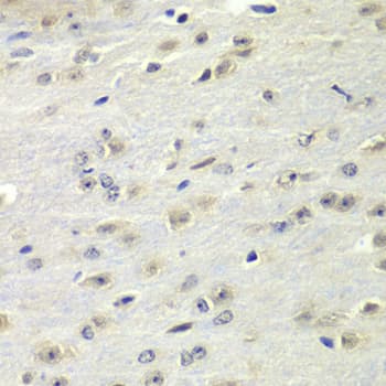 Polyclonal Rabbit anti-Human FMR1 / FMRP Antibody (IHC, IF, WB)