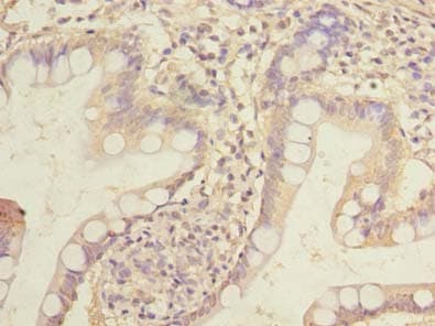 HOXC11 Antibody