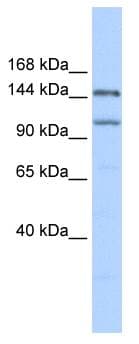 Polyclonal Rabbit anti-Human PRDM9 Antibody (aa431-480, IHC, WB)