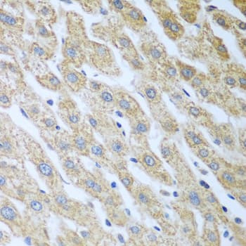 Polyclonal Rabbit anti-Human EIF2AK2 / PKR Antibody (IHC, WB)