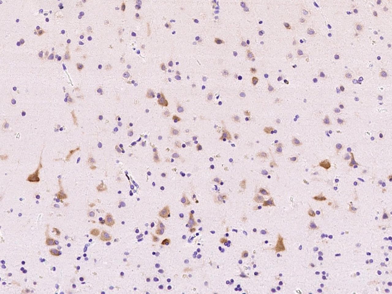 ABI2B / ABI2 Antibody (Preservative Free)
