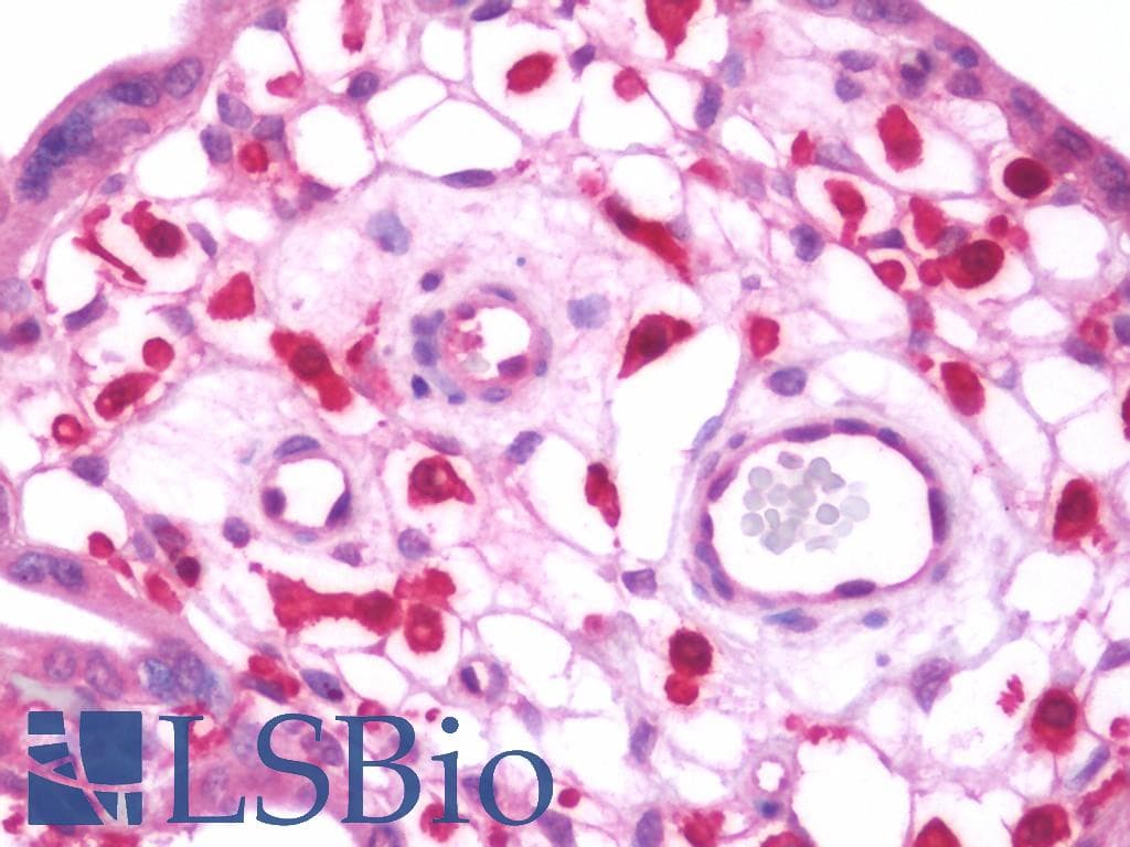 IHC-plus™ Polyclonal Rabbit anti-Human JAM2 Antibody (aa1-294, IHC, WB)