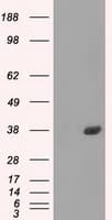 FCGR2 / CD32 Antibody (clone OTI19C10)