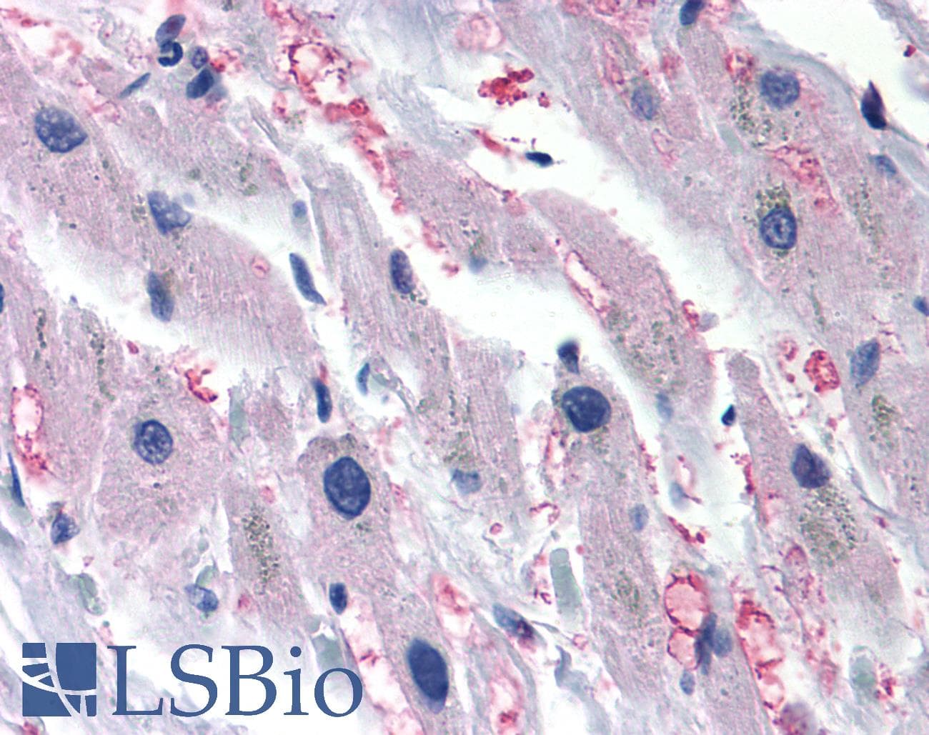 PathPlus™ ADRA1A Antibody (Cytoplasmic Domain)