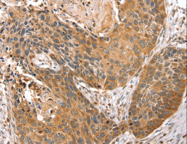 STX10 / Syntaxin 10 Antibody