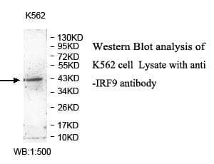 Polyclonal Rabbit anti-Human ISGF3 / IRF9 Antibody (aa239-389, IHC, WB)