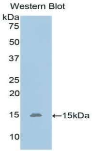 OLFM4 / Olfactomedin 4 Antibody (aa407-510)