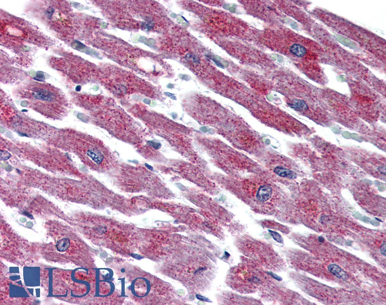 IHC-plus™ Polyclonal Rabbit anti-Human ADCYAP1R1 / PAC1 Receptor Antibody (N-Terminus, IHC)