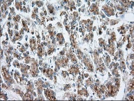 HMRF1L / MTRF1L Antibody (clone OTI2C6)