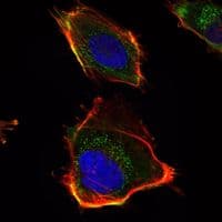 HAS1 / HAS Antibody (clone 30000000000)