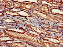 Polyclonal Rabbit anti-Human RPS2 / Ribosomal Protein S2 Antibody (IHC, WB)