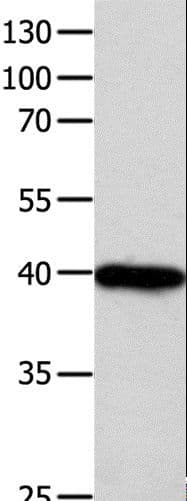 FOXL1 Antibody