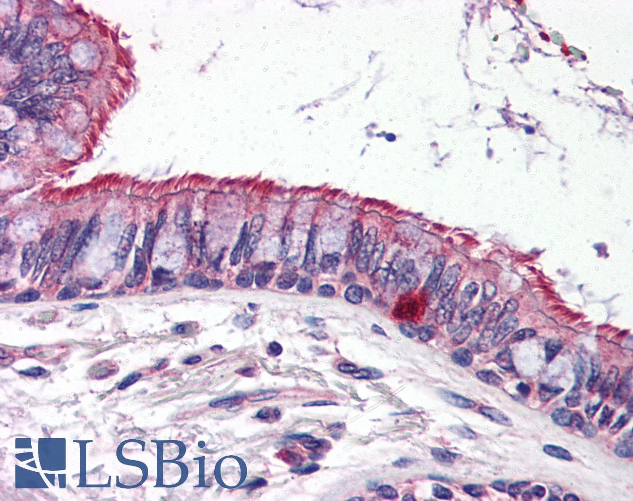 IHC-plus™ Polyclonal Rabbit anti-Human ELOVL6 Antibody (IHC, IF, WB)